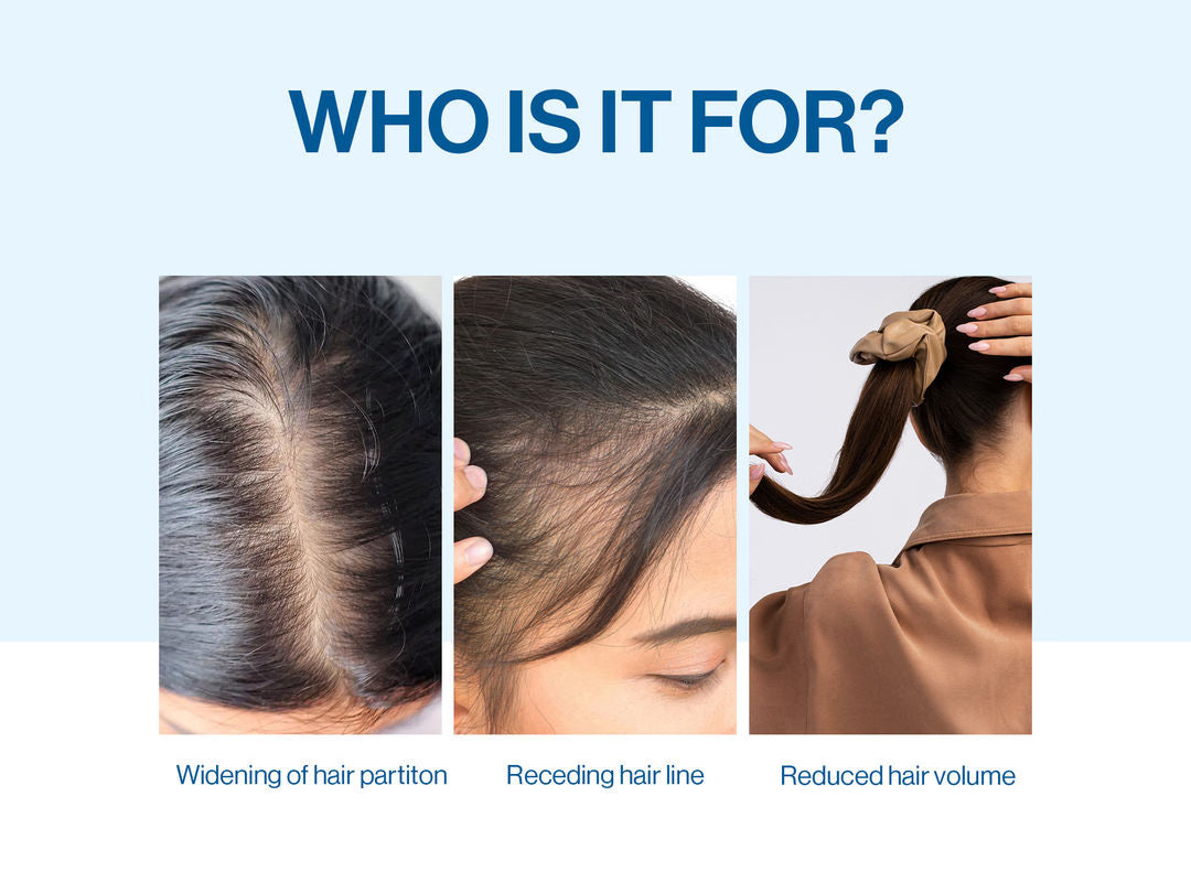 The Scalpwise Formula – End Hair Loss, Regrow Thicker Hair. +  50% OFF