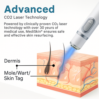 DermaPure Pro + Clear Skin, Renewed Confidence - 60% OFF