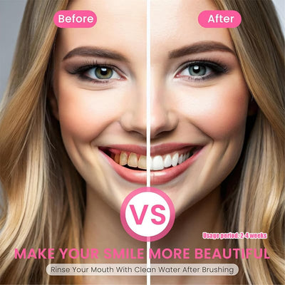 DentaBright Niacinamide Elixir - Reclaim Your Dazzling Smile & Unshakeable Confidence - 50% OFF