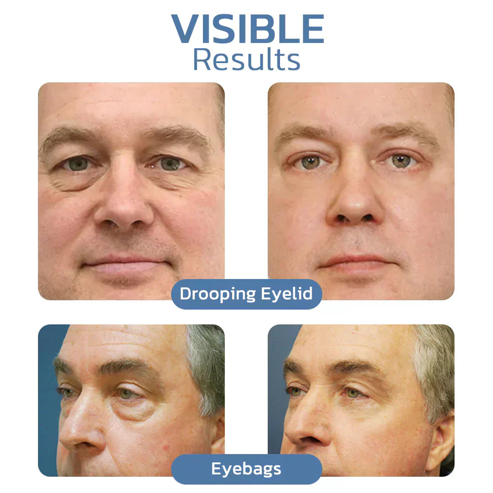 Awaken Peptide Lifting Eye Gel - A Visible Eye Lift in a Jar + 50% OFF