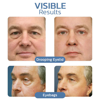 Awaken Peptide Lifting Eye Gel - A Visible Eye Lift in a Jar + 50% OFF
