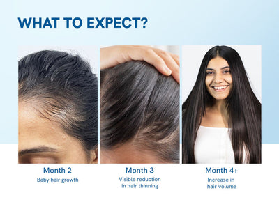 The Scalpwise Formula – End Hair Loss, Regrow Thicker Hair. +  50% OFF