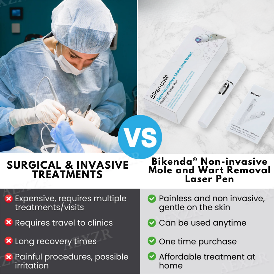 SkinRenew Pro Laser Pen - Non-Invasive Mole & Wart Removal Tool – 50% OFF