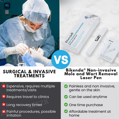 SkinRenew Pro Laser Pen - Non-Invasive Mole & Wart Removal Tool – 50% OFF