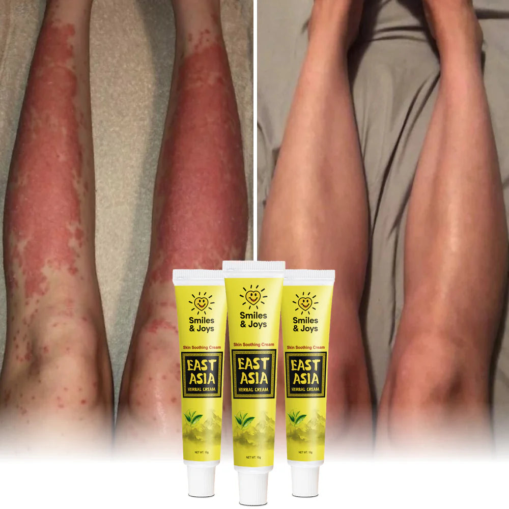 DermaCalm Balm - End the Itch, Heal Your Skin - 50% OFF