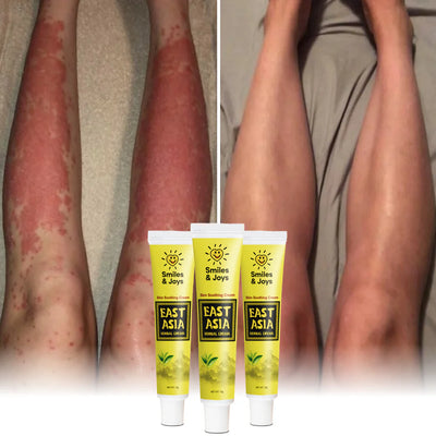 DermaCalm Balm - End the Itch, Heal Your Skin - 50% OFF