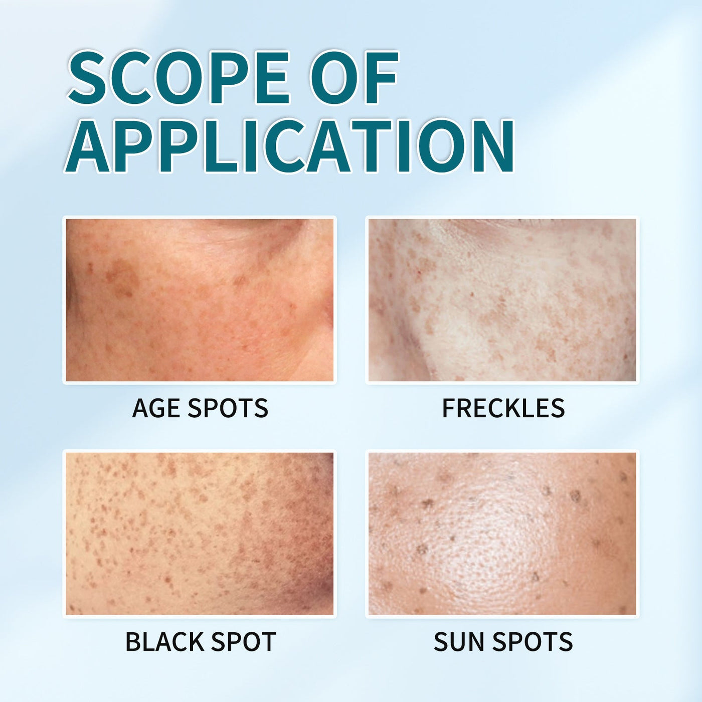 AuraRenew Blemish Cream - Erase Spots & Wrinkles - 50% OFF