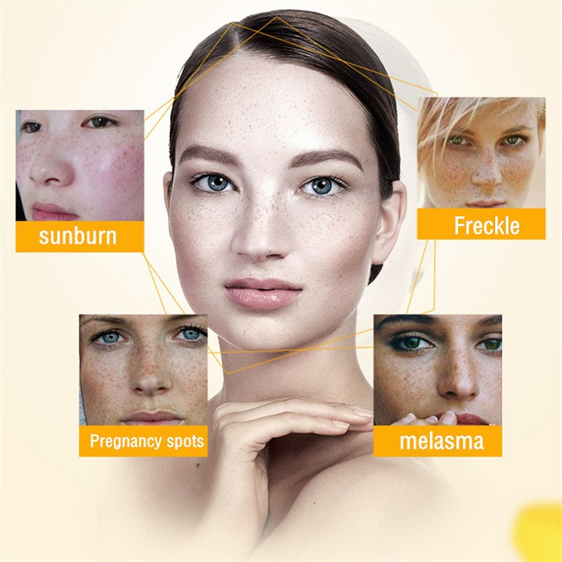 AuraRenew Blemish Cream - Erase Spots & Wrinkles - 50% OFF