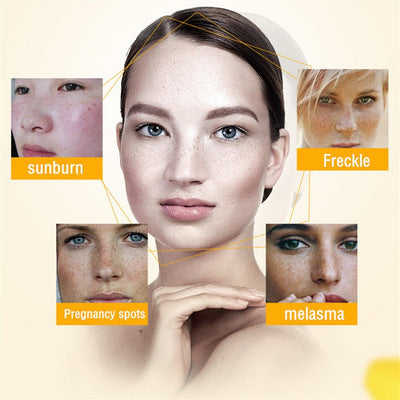 AuraRenew Blemish Cream - Erase Spots & Wrinkles - 50% OFF