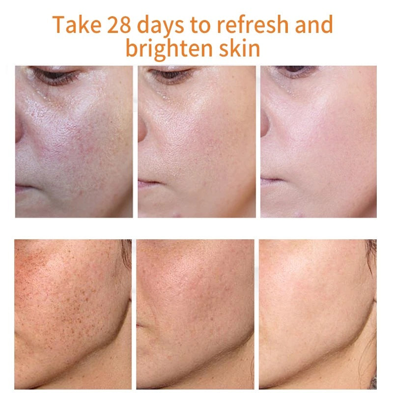 AuraRenew Blemish Cream - Erase Spots & Wrinkles - 50% OFF