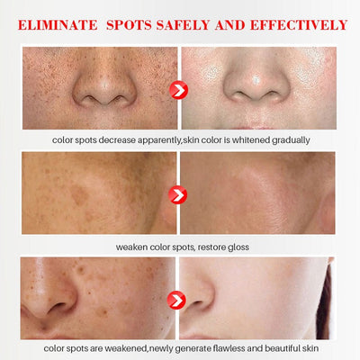 AuraRenew Blemish Cream - Erase Spots & Wrinkles - 50% OFF