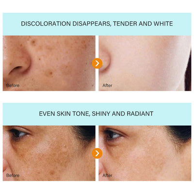AuraRenew Blemish Cream - Erase Spots & Wrinkles - 50% OFF