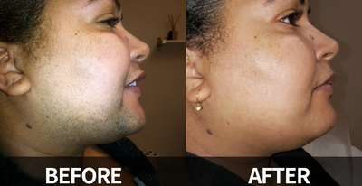 DermaSmooth Radiance-  Reveal Your Flawlessly Smooth, Confident Glow 1 + 1 FREE