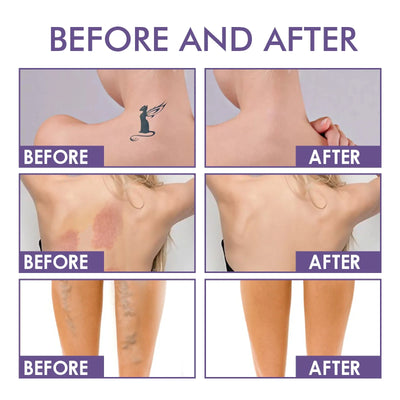 DermaVeil Body Perfector - Flawless Legs, Instantly - 50% OFF
