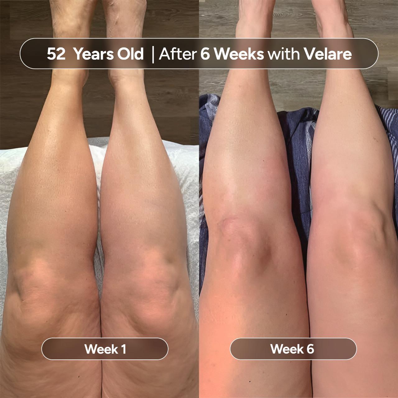 Velare Oil - Rebuild Smooth, Firm Skin -  50% OFF TODAY