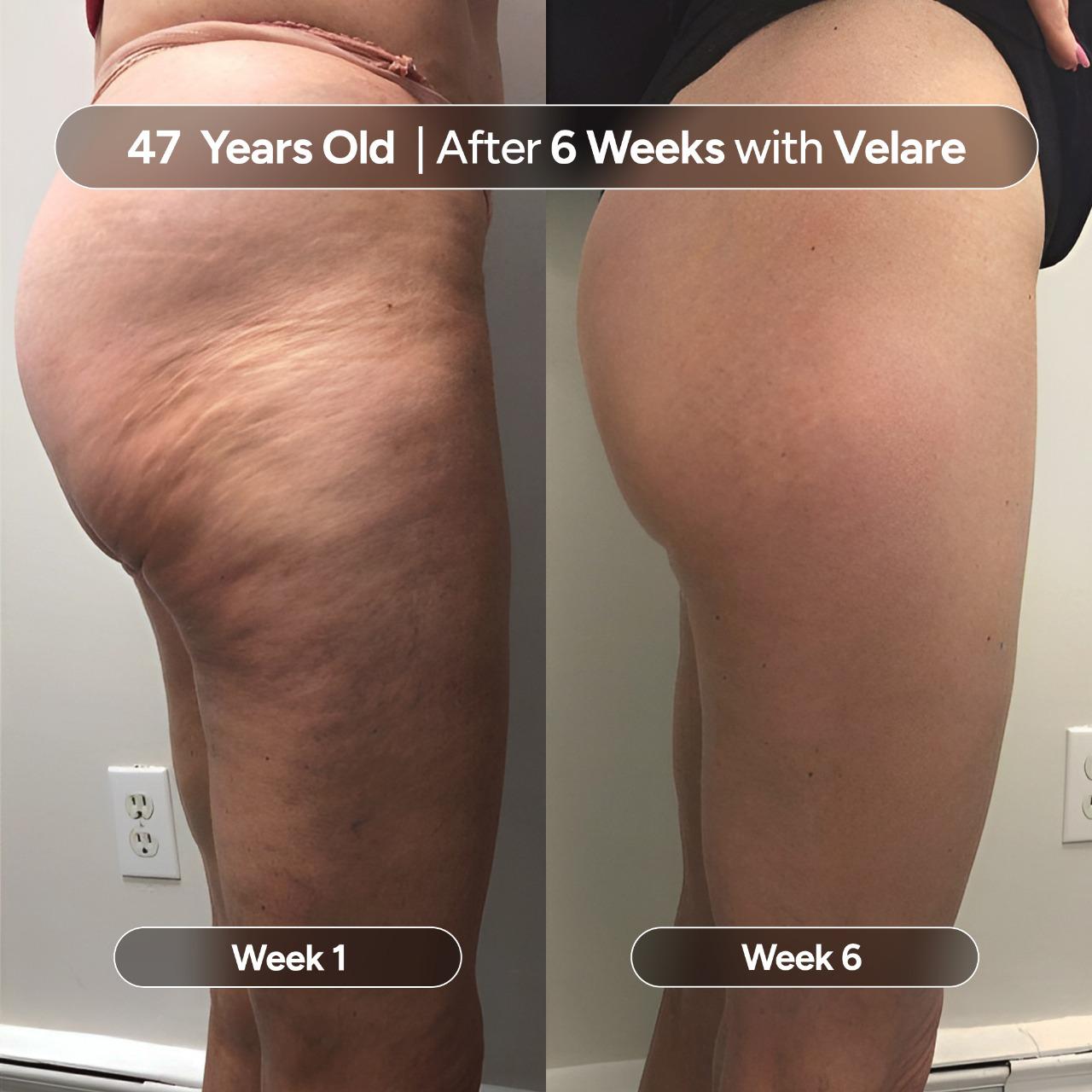 Velare Oil - Rebuild Smooth, Firm Skin -  50% OFF TODAY
