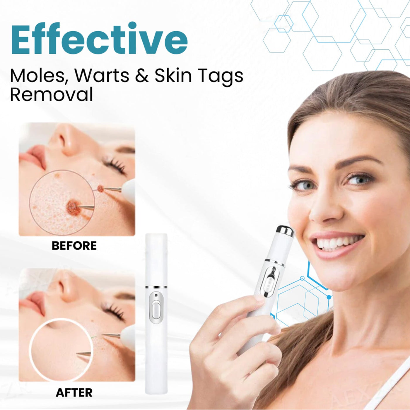 DermaZap - Flawless Skin, No Scars, No Surgery - 50% OFF
