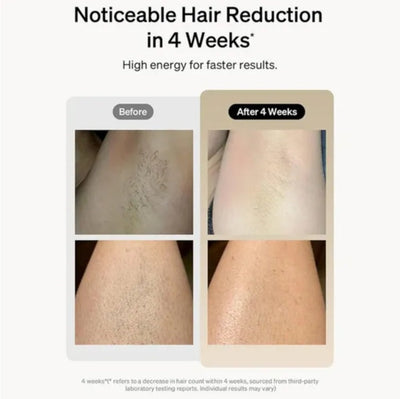 GlowBare IPL Hair Remover – Silky Skin Starts at Home - 50% OFF