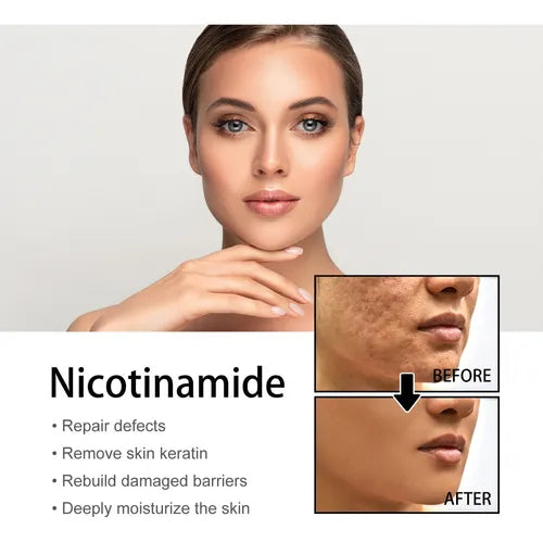 DermaClarity Elixir - Erase Post-Acne Marks - 50% OFF
