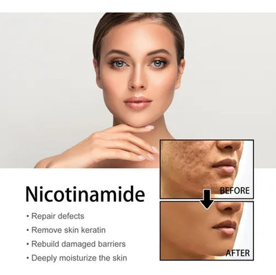 DermaClarity Elixir - Erase Post-Acne Marks - 50% OFF