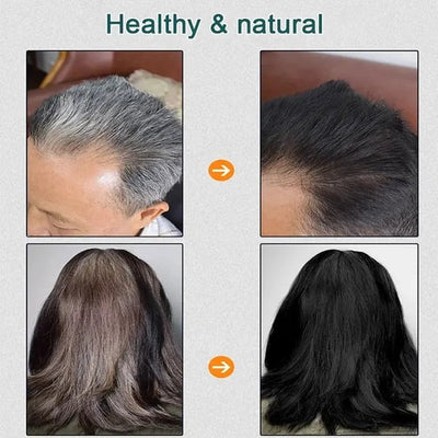 EverYouth Plant Dye - Your Natural Grey Hair Solution - 1+1 FREE