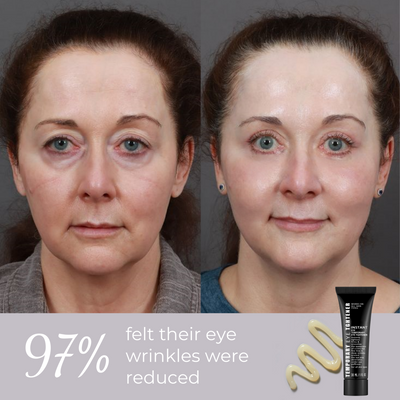 Ageless Aura Instant Lift + Erase Years in Seconds, Reveal a Timeless, Vibrant Gaze - 50% OFF