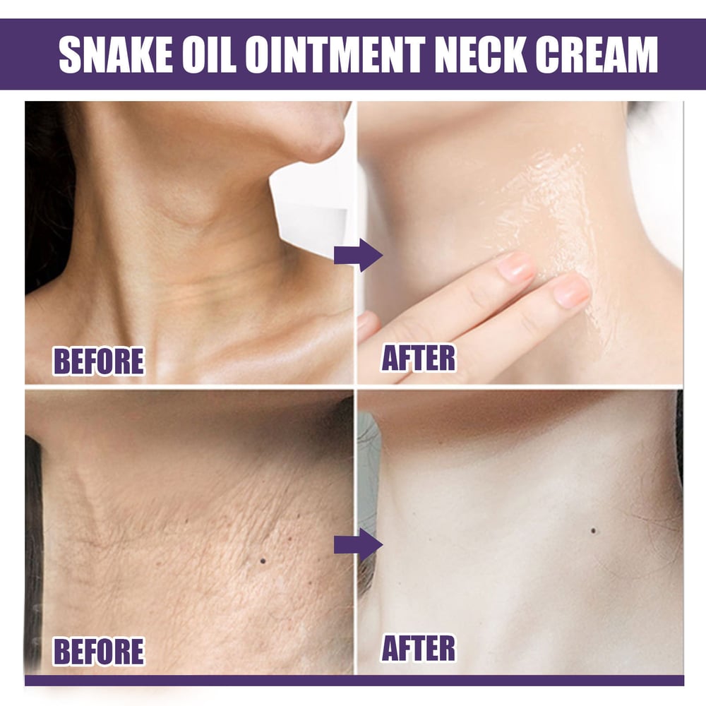 LiftaGlow Neck Stick Oil-Nourishing Firming Balm - Targets Neck Wrinkles & Sagging Skin - 1+1 FREE