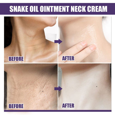 LiftaGlow Neck Stick Oil-Nourishing Firming Balm - Targets Neck Wrinkles & Sagging Skin - 1+1 FREE