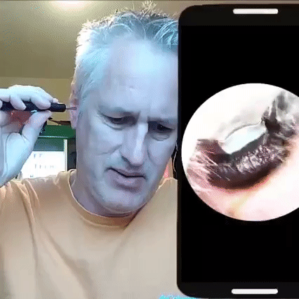ClearEar™ - Ear Wax Removal Spoon With Camera (Limited Time Offer 50% Discount)