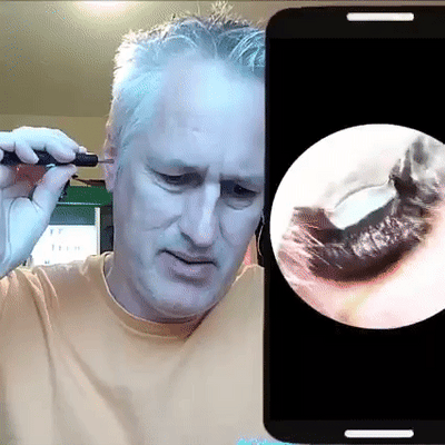 ClearEar™ - Ear Wax Removal Spoon With Camera (Limited Time Offer 50% Discount)