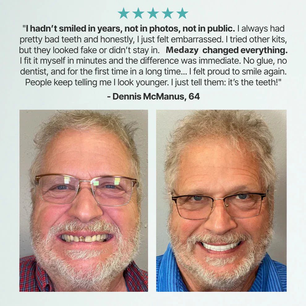 FormaSmile Dentures - Reclaim Your Confident Smile -  50% OFF
