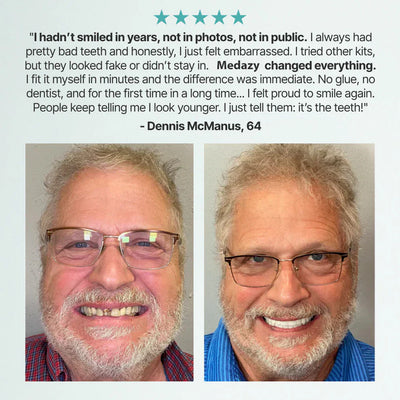 FormaSmile Dentures - Reclaim Your Confident Smile -  50% OFF