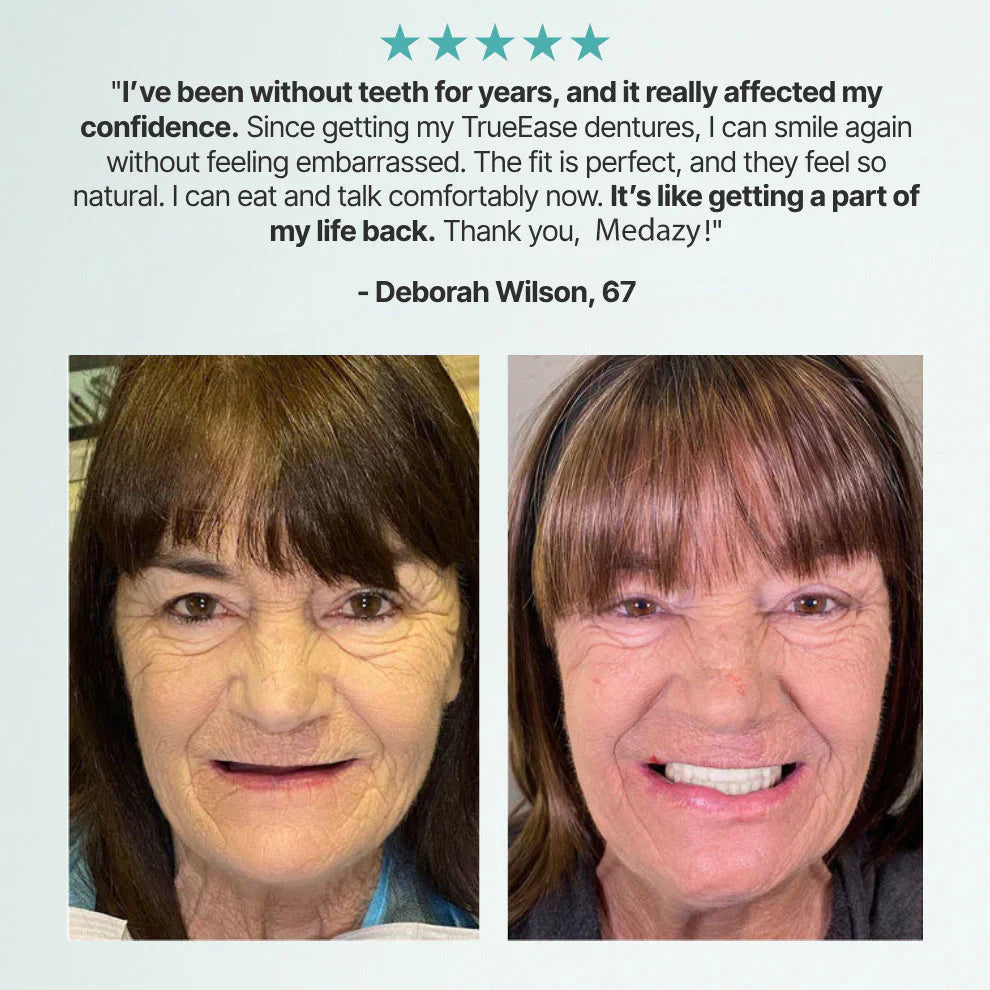 FormaSmile Dentures - Reclaim Your Confident Smile -  50% OFF