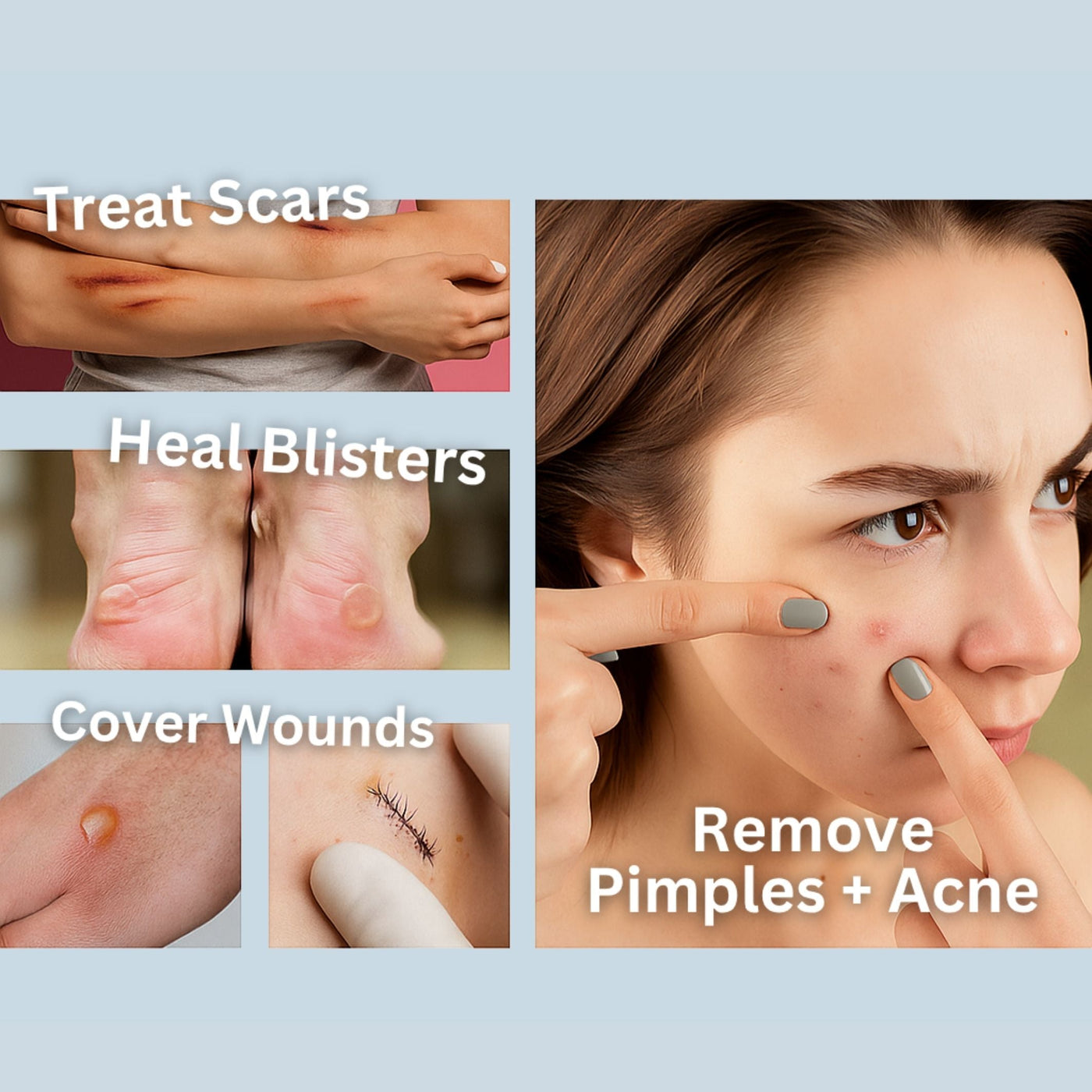 The Hydrocolloid Pimple Patch - A Blemish-Free Look, Overnight + 50% OFF