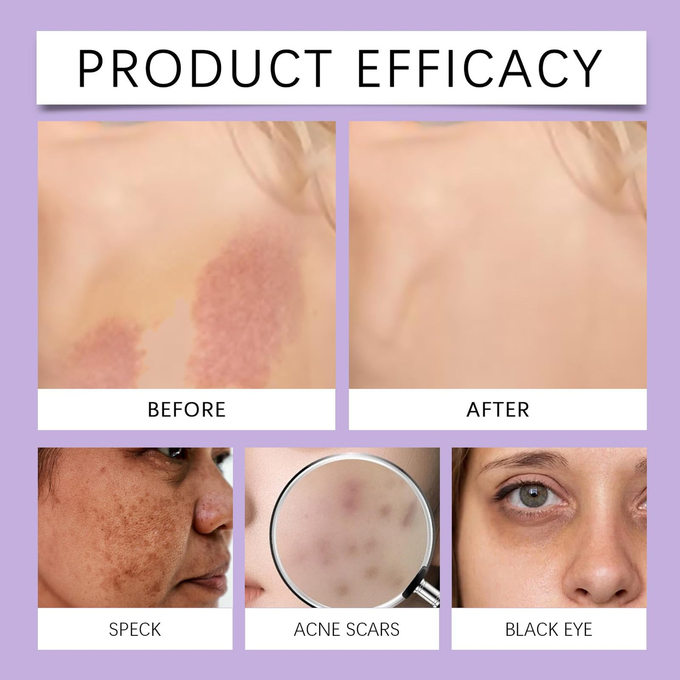 The Second-Skin Concealer - Full Coverage, Weightless Feel + 50% OFF