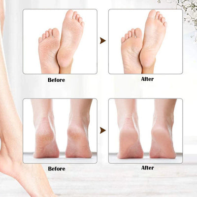 PediSilk Pro – Your At-Home Pedicure Expert - 50% OFF
