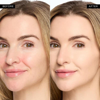 ChromaCorrect Elixir + Banish Shadows, Unveil Luminous, Flawless Under-Eyes - 50% OFF