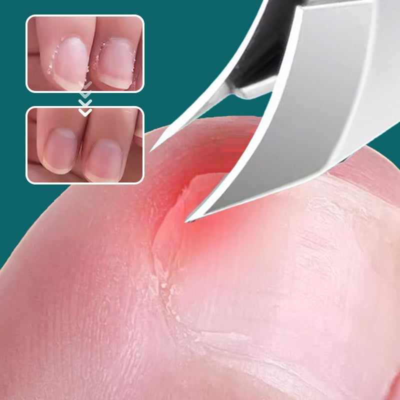 PrecisionGuard 25° Slant Edge Nail Clipper Set – Clean Cuts, No Mess - 50% OFF