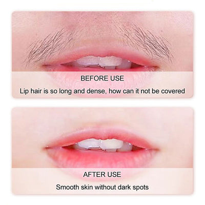 SilkEase Facial Hair Removal Cream – Smooth Skin, Zero Pain - 50% OFF