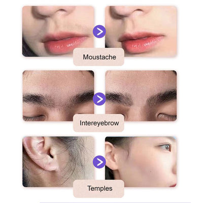 SilkEase Facial Hair Removal Cream – Smooth Skin, Zero Pain - 50% OFF