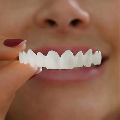 Instant Smile Veneers – Natural White Finish Removable Design - 50% OFF